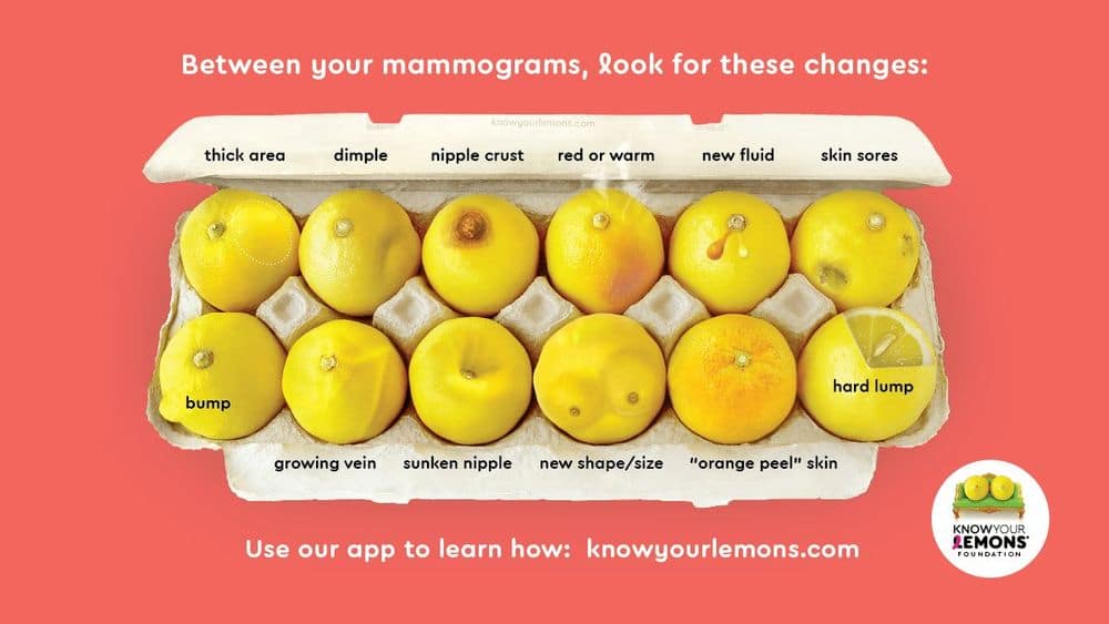 U susret Nacionalnom danu borbe protiv raka dojke, 20.mart 2026.